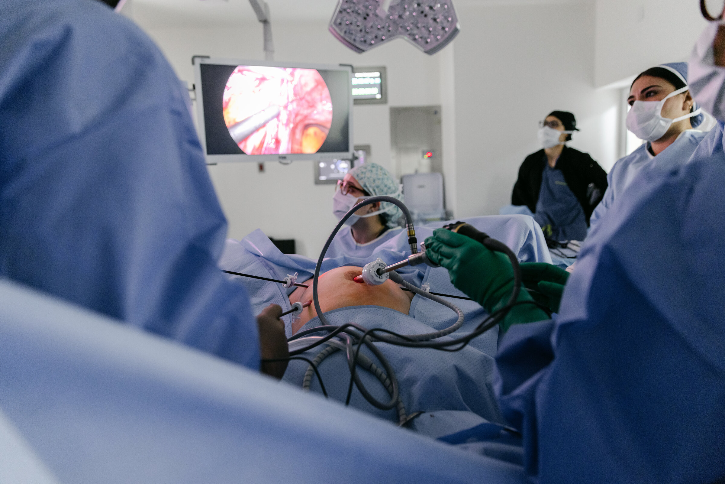 Equipo quirúrgico del Dr. César Cantú durante histerectomía laparoscópica en Hospital Ángeles Valle Oriente